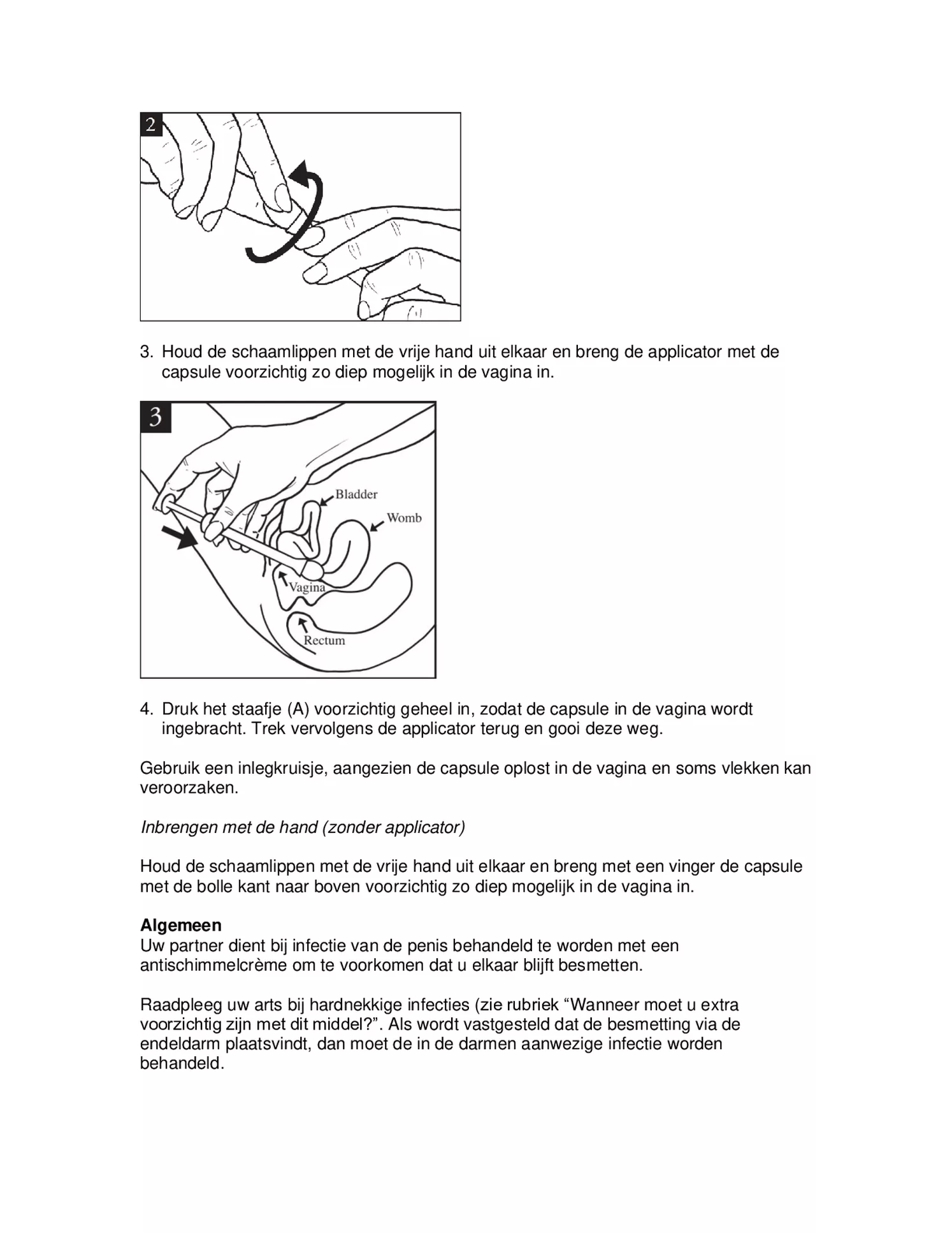 Canesten Gyno 1 Zachte Capsule afbeelding van document #4, bijsluiter