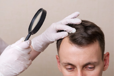 dermatoloog checkt het haarverlies van een man