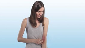 vrouw met eczeem vrouw met eczeem