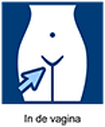 In de vagina In de vagina