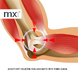 MX Health Premium Neopreen Tennis Elbow Support - Universal 1ST MX Health Premium Tennis Elbow Neopreen Support - Universal anatomische afbeelding elleboog MX Health Premium Neopreen Tennis Elbow Support - Universal 1ST MX Health Premium Tennis Elbow Neopreen Support - Universal anatomische afbeelding elleboog