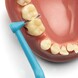 TePe Interdentale Rager Angle Blauw 0,6mm 1ST reiniging kiezen