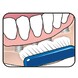 TePe Implantaat/Orthodontie Tandenborstel 1ST reiniging prothese