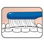 TePe Implantaat/Orthodontie Tandenborstel 1STreiniging beugel