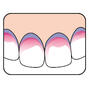 TePe PlaqSearch Tabletten 10TBverkleuring tanden