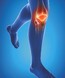 Epitact Physiostrap Medical Kniebeschermer Maat XS 1ST 9569 Epitact Physiostrap Medical Kniebeschermer Maat XS 1ST 9569