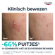 Eucerin DermoPure Clinical Triple Action Fluid 40ML Klinisch bewezen resultaat Eucerin DermoPure Clinical Triple Action Fluid 40ML Klinisch bewezen resultaat