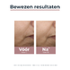 Eucerin Anti Pigment Dagcrème Tinted SPF30 Medium 50ML bewezen resultaten